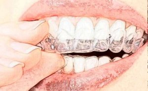 徐州三甲牙科医院排名,探店可选