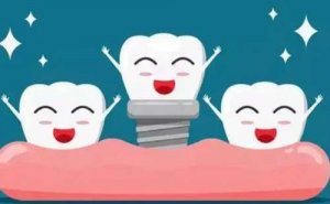 赣州牙齿种植需要多少钱