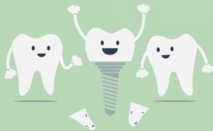 淮北前牙种植需要多少钱