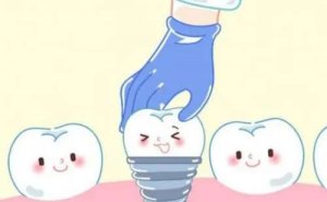 青岛牙博士种植牙价格是多少?大概需要5000元起步