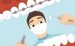 南昌龅牙矫正价目表