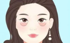 重庆美莱整形内切去眼袋能做吗?内切去眼袋医生介绍 重庆美莱整形内切去眼袋能做吗?内切去眼袋医生介绍