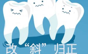 南充隐适美价格展示