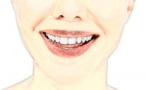 成都锦江贝臣口腔门诊部种植牙怎么样?价格优惠吗？