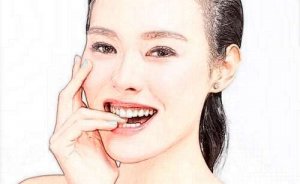 郑州做正颌手术需要多少钱?分享当地正规医院