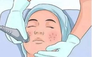 脸长斑是什么原因？原因分析及去除方法