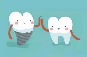 昆明种植牙多少钱一颗2023年？推荐哪几家口碑不错的医院？