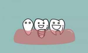 广州种牙医院排行榜好的有哪些？医院选择攻略，资料详细