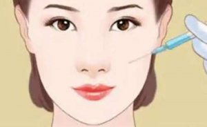 乌鲁木齐打玻尿酸价格是多少？整形医院公布，2000元左右起