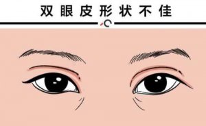 贵阳双眼皮医院排名七强，医院介绍