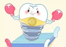 西安种植牙价格大概多少钱一颗？推荐几家种牙效果好的医院！