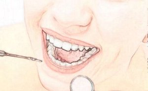 株洲牙齿根管治疗要多少钱？正规医院介绍、价格透明