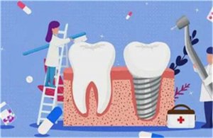 重庆种植牙一颗多少钱？医院实力介绍，点击一览