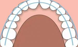 长春牙齿矫正价格表分享！推荐几家口碑不错的机构！