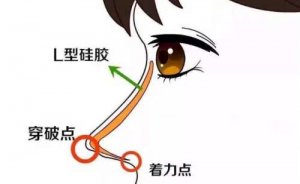 深圳隆鼻前十强医院排名实力展示!