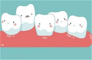 23岁矫正牙齿来得及吗？医生解读时间窗口