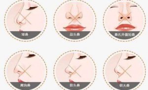 赣州自体脂肪隆鼻好的医院公开！华美、薇琳等七家实力医院