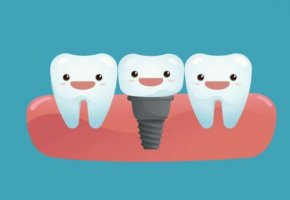 北京牙科医院种牙价格贵不贵？下面几家医院技术在线！