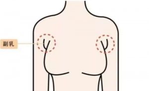 兰州去副乳手术哪个医院好？正规医院前6介绍，含价格表