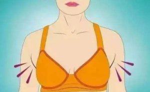 沈阳去副乳手术大概需要多少钱？专业医院+手术价格介绍