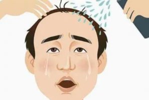 南京碧莲盛植发价格贵不贵？医院实力点评|收费标准公布！