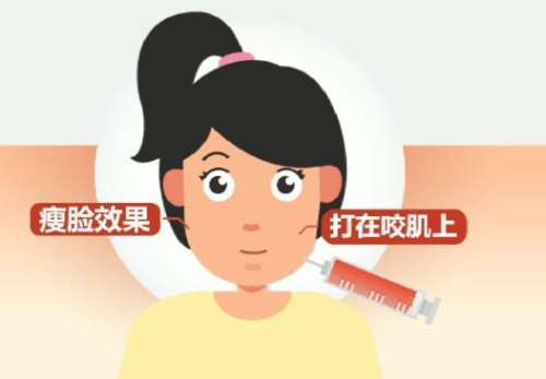 注射瘦脸动漫图01.jpg