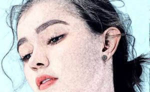 皖南医学院第一附属医院隆鼻技术评价怎么样?求美案例