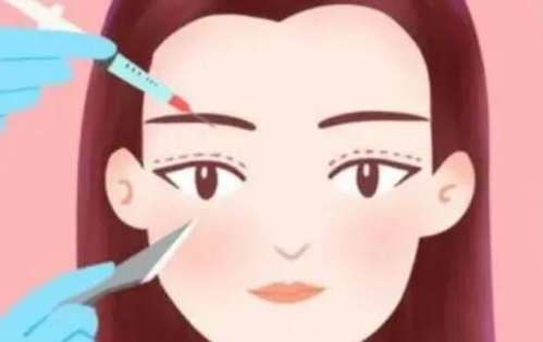 双眼皮