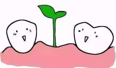 牙齿种植
