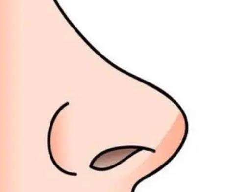 隆鼻