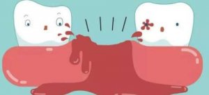 武汉牙基地口腔拔牙费用贵不贵？医院简介|真人拔牙术后反馈图！