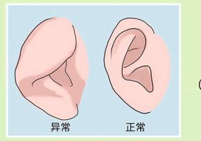 南宁耳再造排名前十口碑好的医院介绍