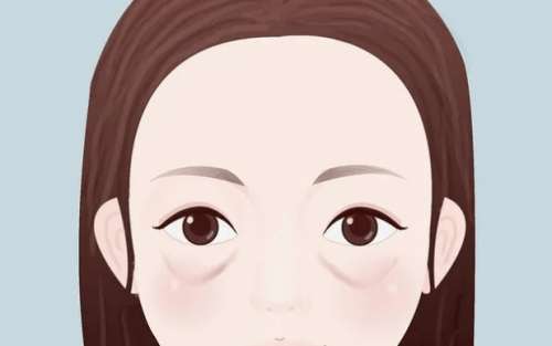 眼袋